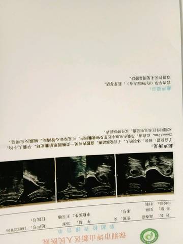 journal_insert_pic_811880953