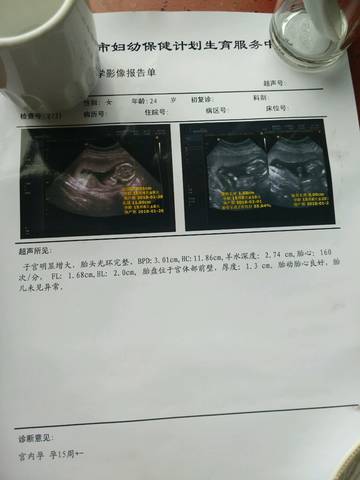 journal_insert_pic_812046659