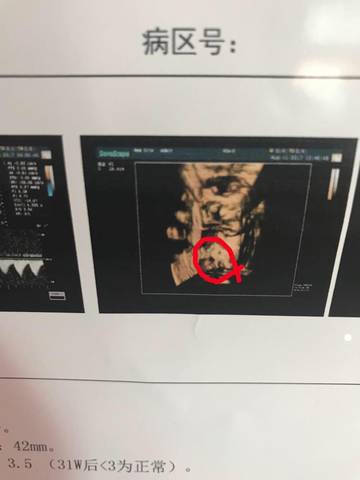 journal_insert_pic_812892019