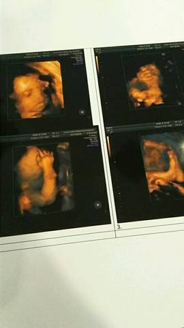 journal_insert_pic_813009351