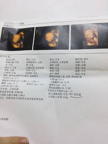 journal_insert_pic_812627447