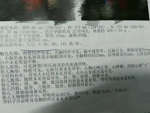 journal_insert_pic_813954760