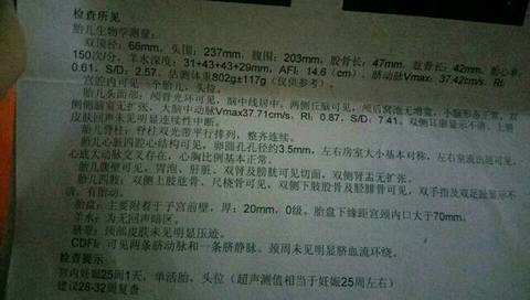 journal_insert_pic_815380879