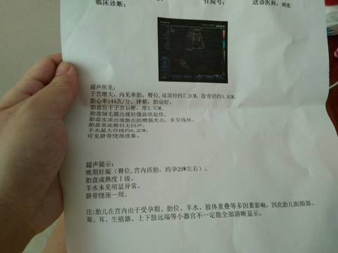 journal_insert_pic_815534060