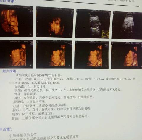 journal_insert_pic_816805711