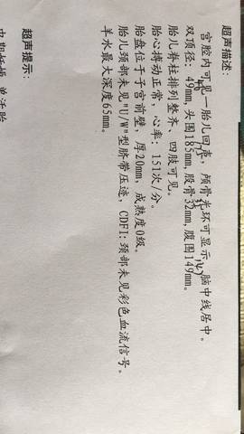 journal_insert_pic_816836004