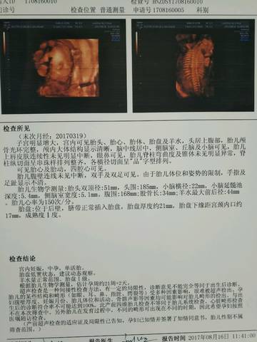 journal_insert_pic_817330085