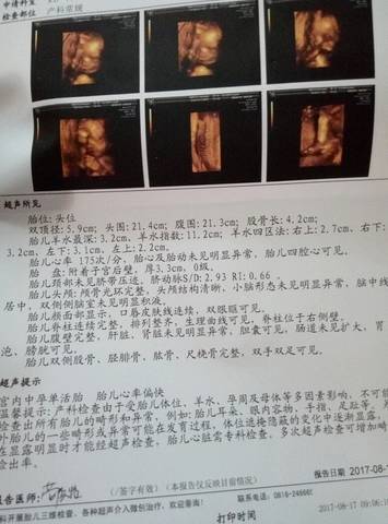 journal_insert_pic_817307068