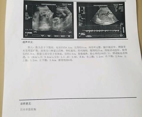 journal_insert_pic_818656047