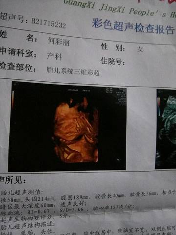 journal_insert_pic_818743879