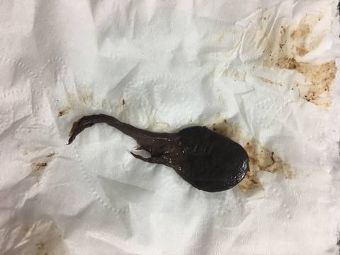 了一点发黄的水,中午流血了,去附属医院产检大夫说让吃个盐酸托利君片