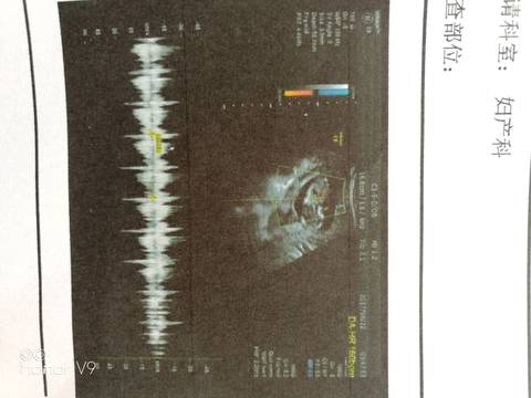 journal_insert_pic_820909000
