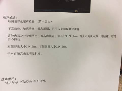 journal_insert_pic_821080105