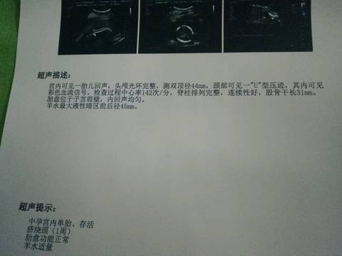 journal_insert_pic_823720089