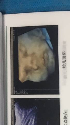 journal_insert_pic_825207882