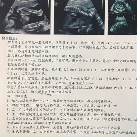 journal_insert_pic_826039257