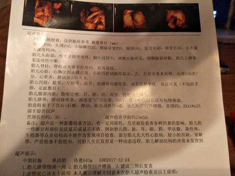 journal_insert_pic_827250463