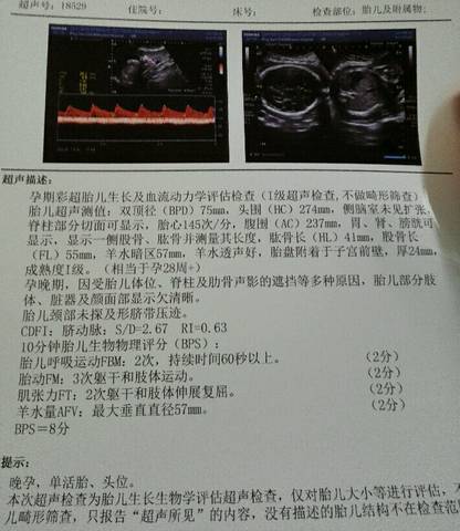 journal_insert_pic_828495502