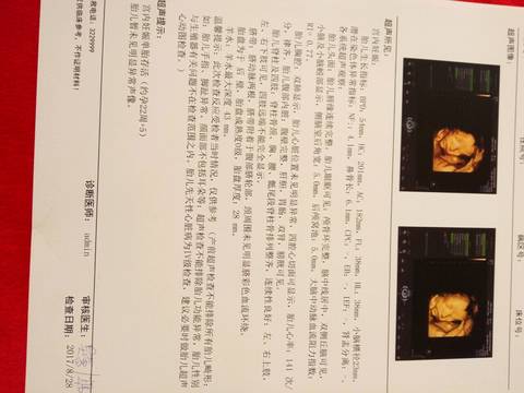 journal_insert_pic_829291403