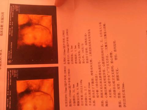 journal_insert_pic_829183012