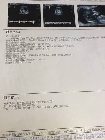 journal_insert_pic_831819168
