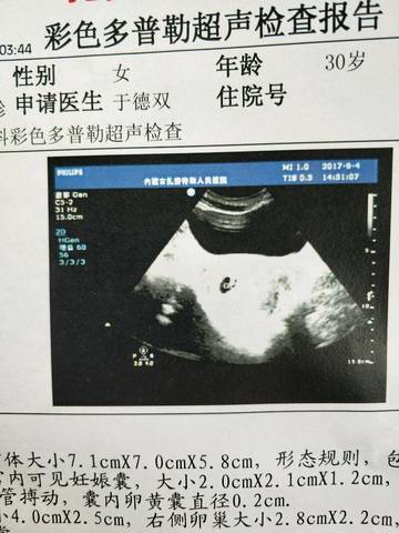 journal_insert_pic_832165641