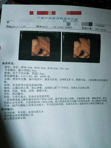 journal_insert_pic_833233163