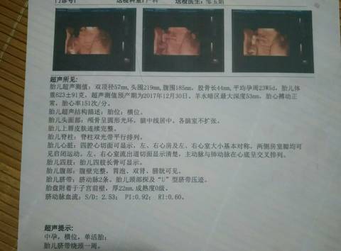 journal_insert_pic_833974552