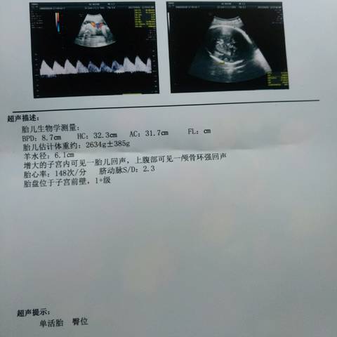 journal_insert_pic_833737457