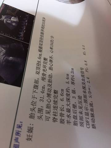 journal_insert_pic_834349725