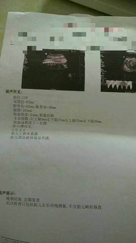 journal_insert_pic_835412413