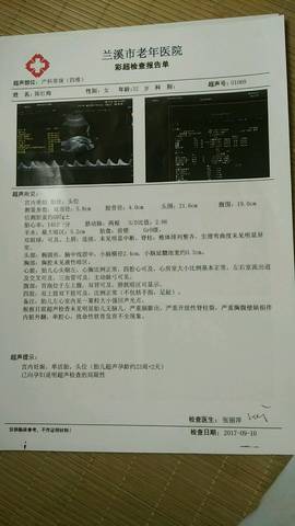 journal_insert_pic_835609927