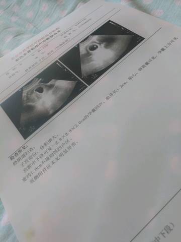 journal_insert_pic_836316265