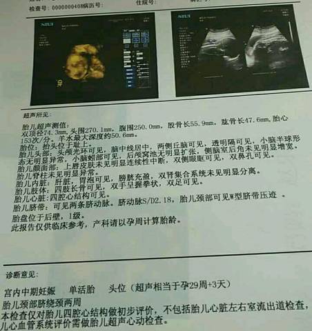 journal_insert_pic_837928523