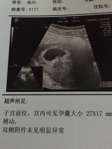 journal_insert_pic_839531392