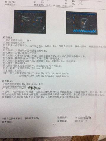 journal_insert_pic_840279930