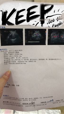 journal_insert_pic_841502372