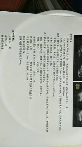 journal_insert_pic_845190110
