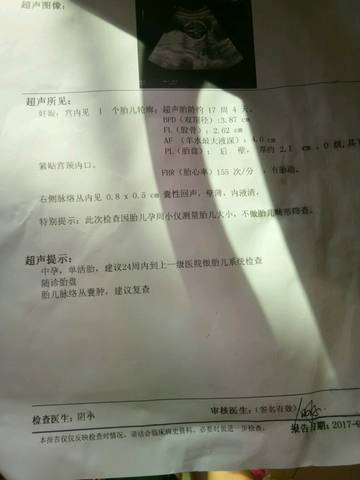 journal_insert_pic_845302209