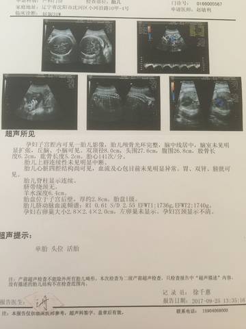journal_insert_pic_847483776