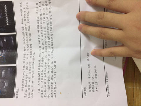 journal_insert_pic_847258257