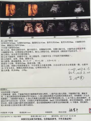 journal_insert_pic_848536924