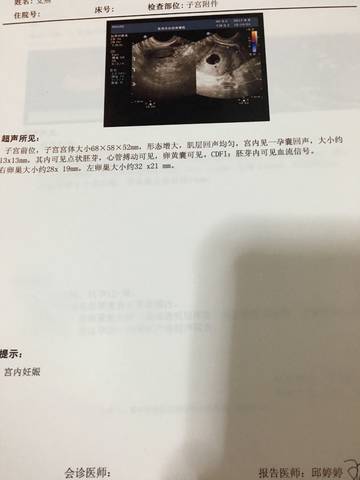journal_insert_pic_849189087