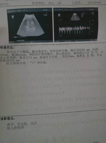 journal_insert_pic_849111146
