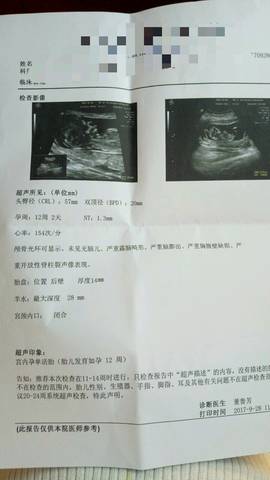 journal_insert_pic_849170119