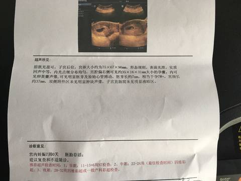 journal_insert_pic_849806408