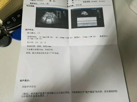 journal_insert_pic_850521288