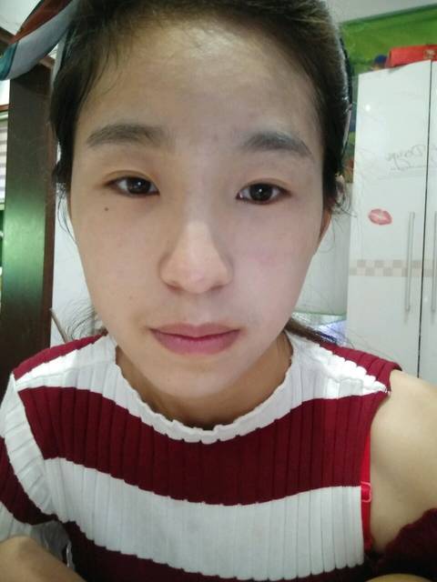 皮肤黄可以产白吗?