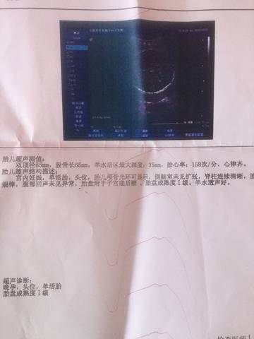 journal_insert_pic_851071429