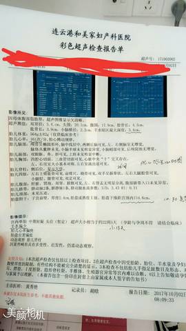 journal_insert_pic_852206641